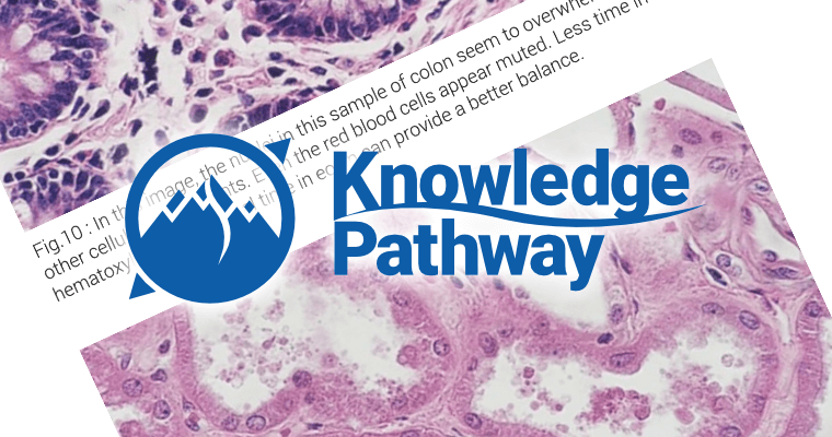 Image collage featuring two scan images from an article, a caption to them, and overlayed across both, the Knowledge Pathway logo.